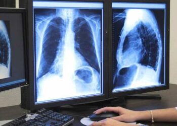 Aproape 1,5 milioane de oameni mor in fiecare an din cauza acestei boli!